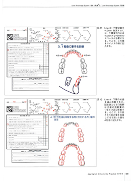 JOP/矯正臨床ジャーナル　2019年9月号