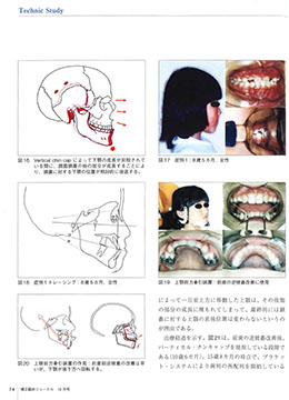 JOP/矯正臨床ジャーナル　2019年10月号