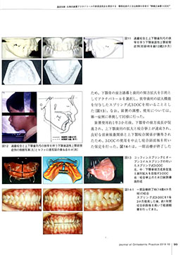 JOP/矯正臨床ジャーナル　2019年10月号