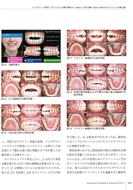 JOP/矯正臨床ジャーナル　2019年11月号