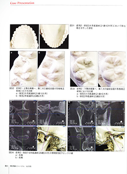 JOP/矯正臨床ジャーナル　2019年12月号