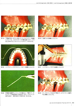 JOP/矯正臨床ジャーナル　2019年12月号