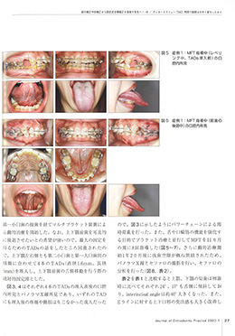 JOP/矯正臨床ジャーナル　2020年1月号
