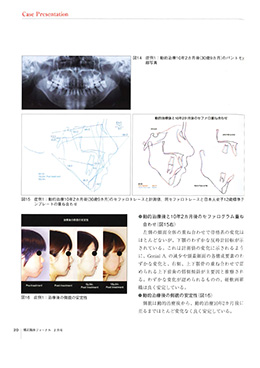 JOP/矯正臨床ジャーナル　2020年2月号