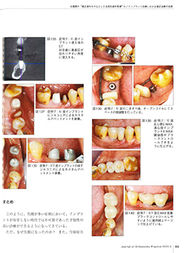 JOP/矯正臨床ジャーナル　2020年2月号