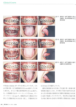 JOP/矯正臨床ジャーナル　2020年3月号