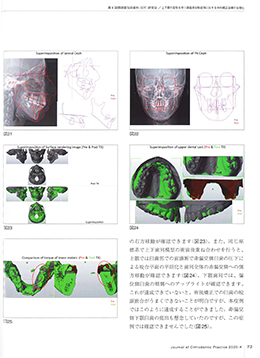 JOP/矯正臨床ジャーナル　2020年4月号