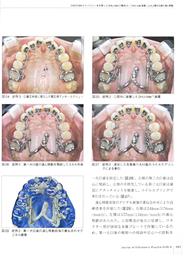 JOP/矯正臨床ジャーナル　2020年4月号