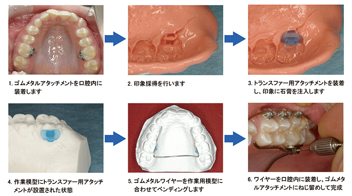 使用方法