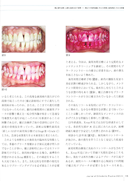 JOP/矯正臨床ジャーナル　2020年5月号