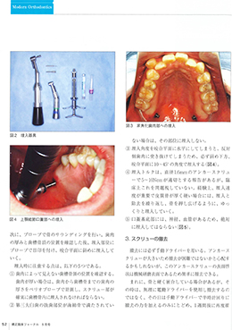 JOP/矯正臨床ジャーナル　2020年5月号