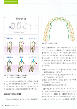 JOP/矯正臨床ジャーナル　2020年6月号