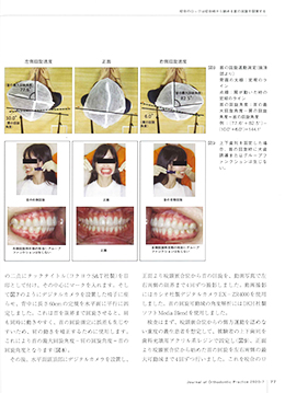 JOP/矯正臨床ジャーナル　2020年7月号