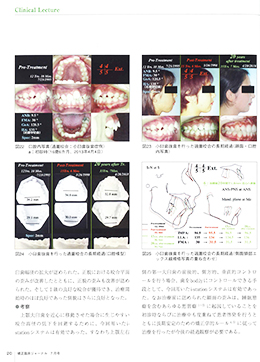 JOP/矯正臨床ジャーナル　2020年7月号