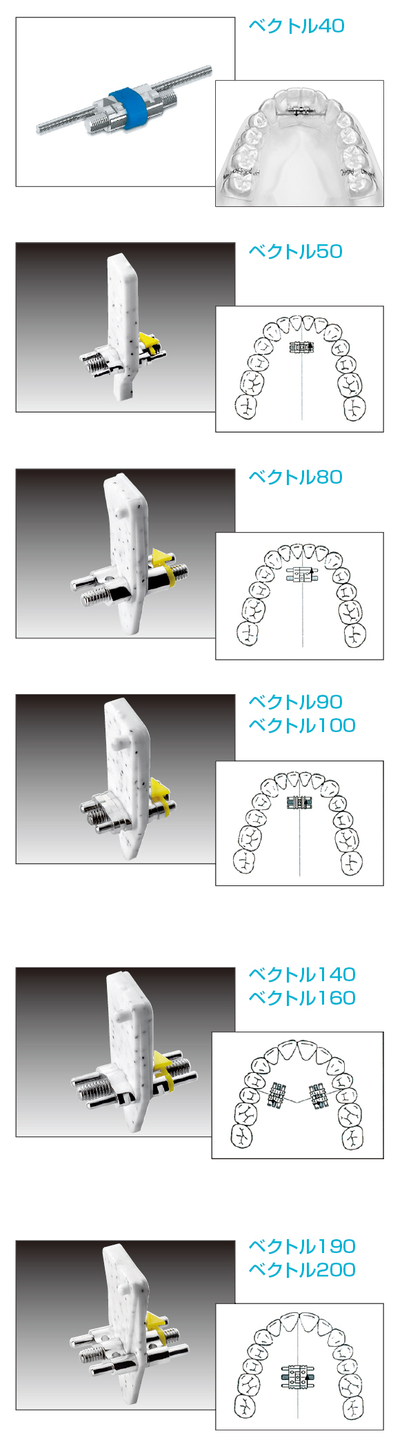 ショイスクリュー