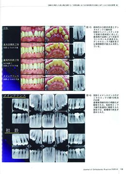 JOP/矯正臨床ジャーナル　2020年8月号