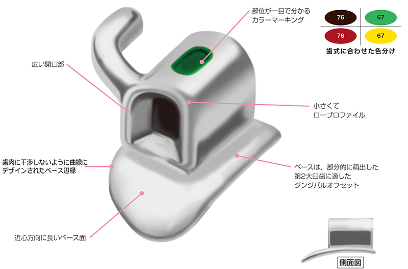 FLIミニチューブ