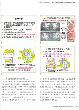 JOP/矯正臨床ジャーナル　2020年9月号