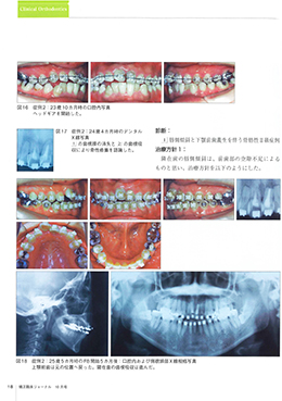 JOP/矯正臨床ジャーナル　2020年10月号
