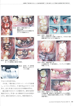 JOP/矯正臨床ジャーナル　2020年10月号