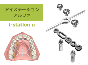 アイステーションアルファ