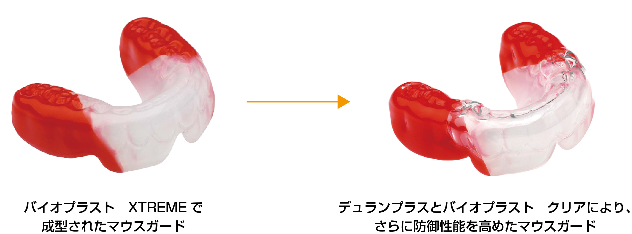 マウスガード