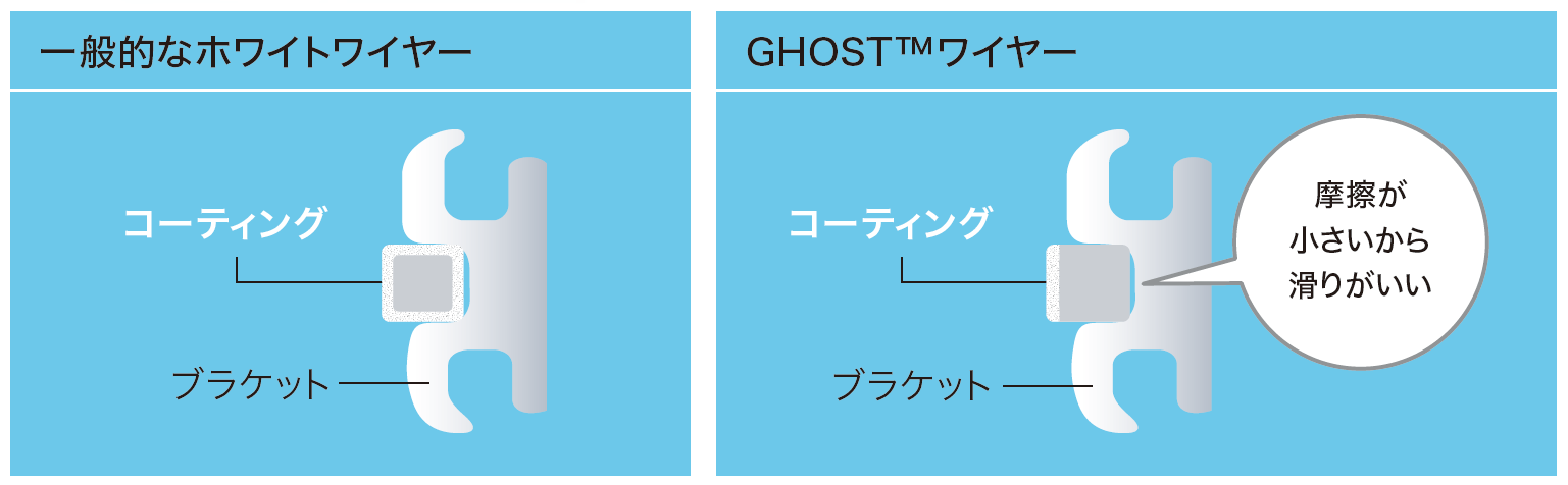 ワイヤー塗装面