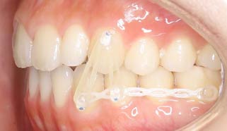 臨床写真 F.M.リングレット